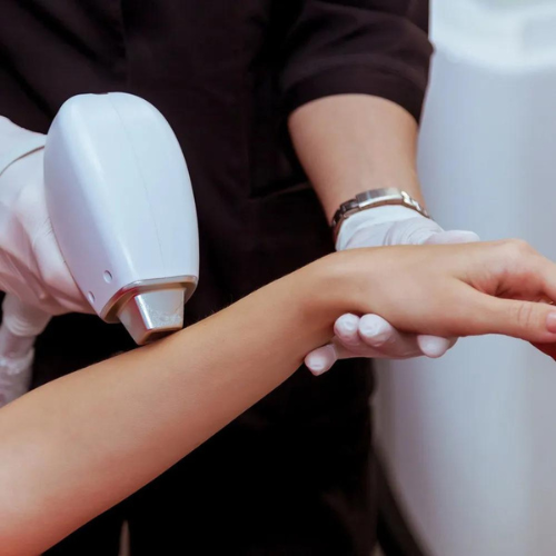 Full Arms with Hands Laser Hair Removal
