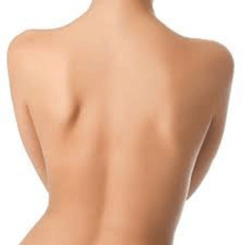 Full Back Bleaching