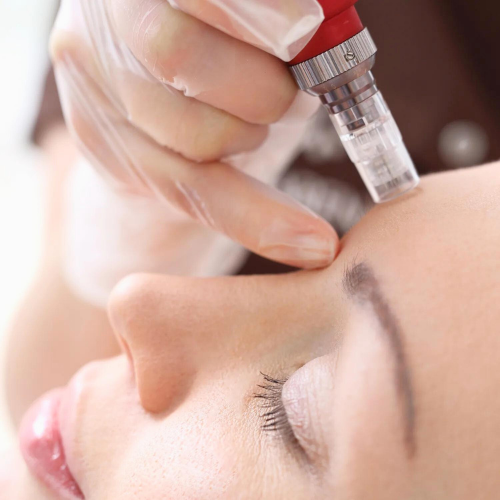 Micro Needling